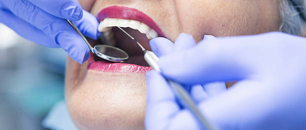 Best Emergency Dental Filling Replacement  in Antwerp, OH